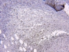 Picture of ایمونوهیستوشیمی